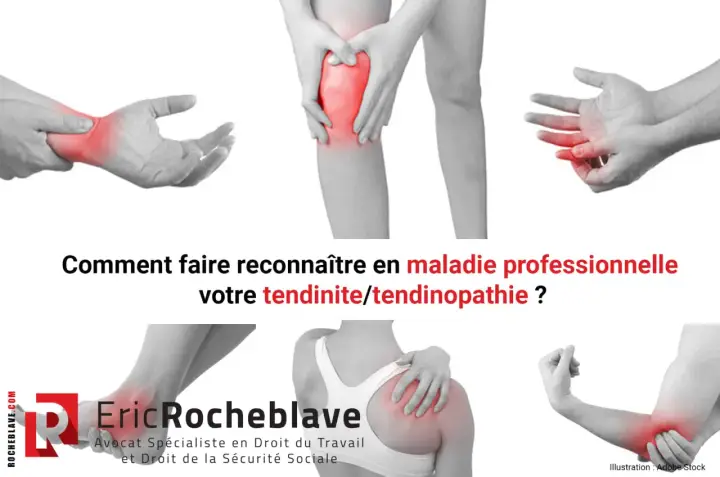 Douleurs articulaires (poignet, genou, doigt, épaule, coude) : comment faire reconnaître votre tendinite en maladie professionnelle.